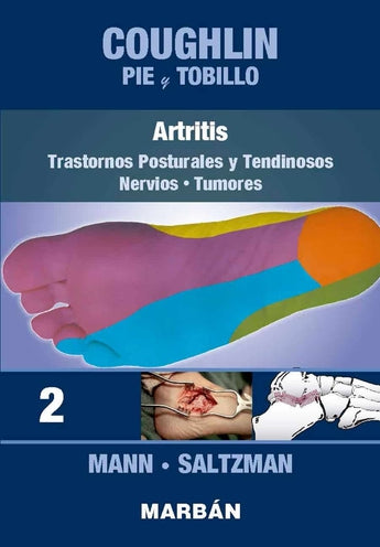 Coughlin Pie y Tobillo 2. Artritis. Trastornos Posturales Y tendinosos. Nervios. Tumores ISBN: 9788418068386 Marban Libros