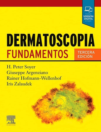 Dermatoscopia. Fundamentos ISBN: 9788491139386 Marban Libros