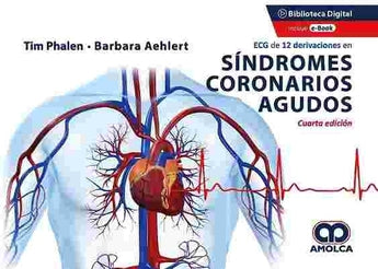 ECG de 12 Derivaciones en Síndromes Coronarios Agudos ISBN: 9789585303546 Marban Libros