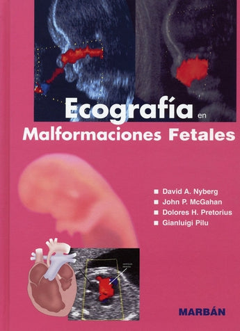 Ecografía en Malformaciones Fetales ISBN: 9788471015914 Marban Libros