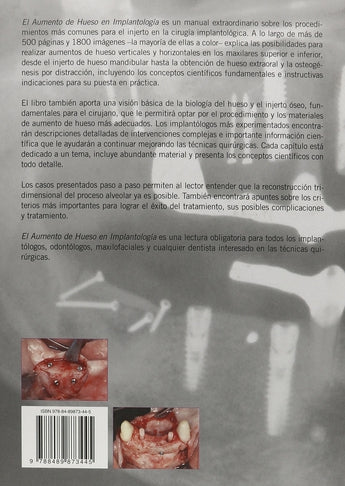 El Aumento de hueso en Implantología ISBN: 9788489873445 Marban Libros