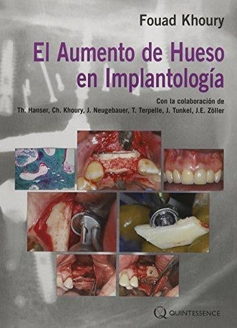 El Aumento de hueso en Implantología ISBN: 9788489873445 Marban Libros