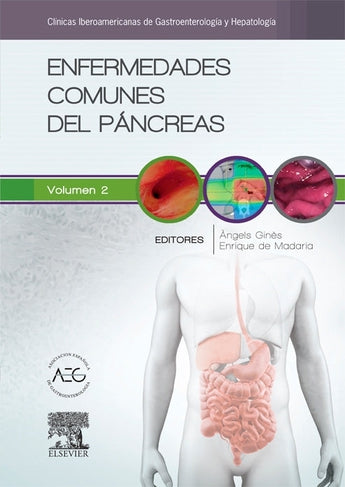Enfermedades comunes del páncreas ISBN: 9788490226735 Marban Libros