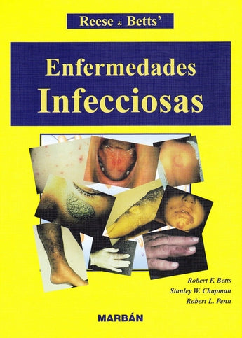 Enfermedades Infecciosas ISBN: 9788471014382 Marban Libros