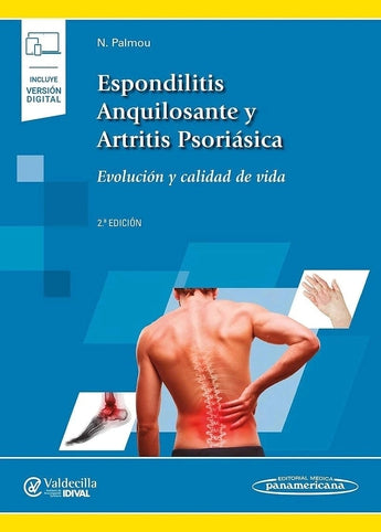 Espondilitis Anquilosante y Artritis Psoriásica. Evolución y Calidad de Vida ISBN: 9788491105138 Marban Libros