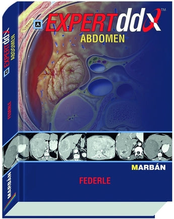 Expert DDX Abdomen ISBN: 9788471017215 Marban Libros