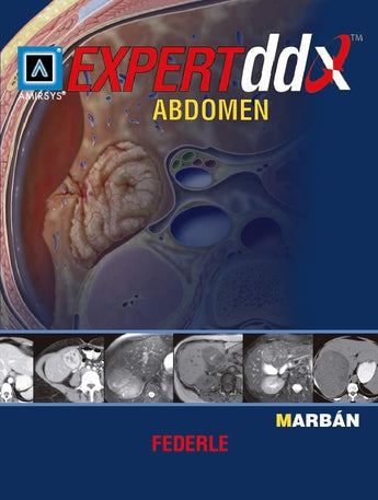 Expert DDX Abdomen ISBN: 9788471017215 Marban Libros