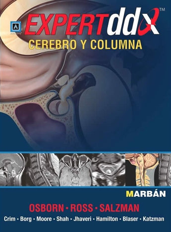 Expert DDX Cerebro y Columna ISBN: 9788471017321 Marban Libros