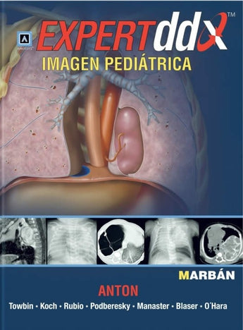 Expert DDX Imagen Pediátrica ISBN: 9788471017284 Marban Libros