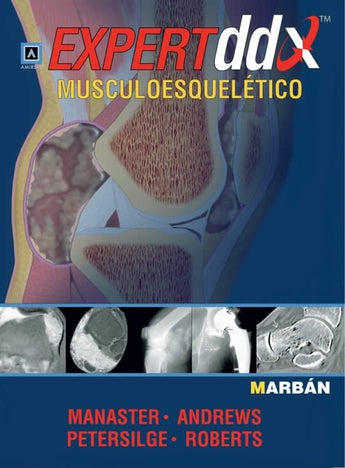 Expert DDX Musculoesquelético ISBN: 9788471017314 Marban Libros