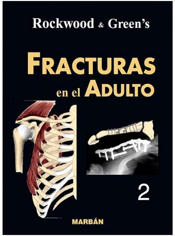 Fracturas en el Adulto. Tomo 2 ISBN: 9788471015532 Marban Libros