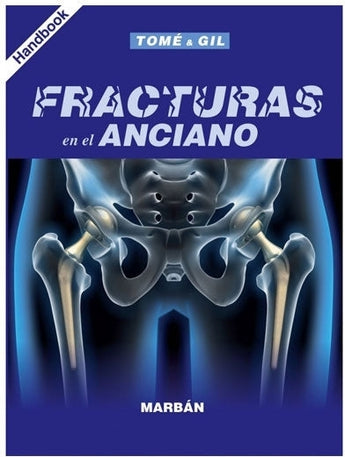 Fracturas en el Anciano Handbook ISBN: 9788417184896 Marban Libros