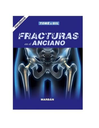 Fracturas en el Anciano - Handbook