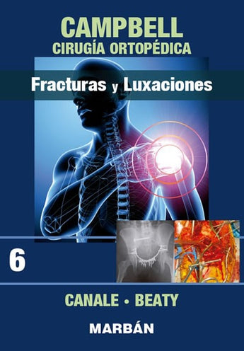 Fracturas y Luxaciones - Campbell Cirugía Ortopédica. Tomo 6 ISBN: 9788471011930 Marban Libros