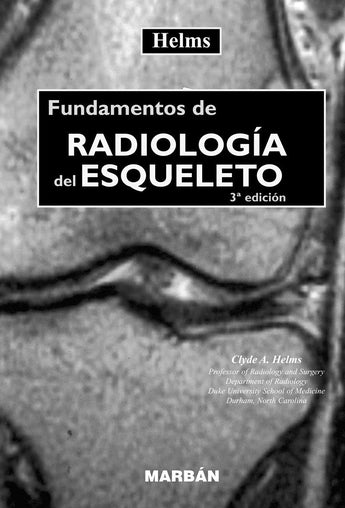Fundamentos de Radiología del Esqueleto - Formato Premium ISBN: 9788471015048 Marban Libros