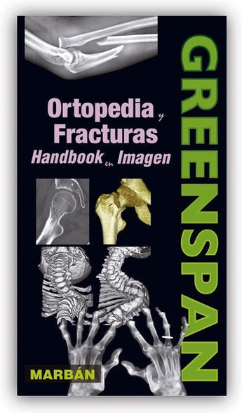 Greenspan - Ortopedia y Fracturas . Handbook en Imagen ISBN: 9788416042005 Marban Libros