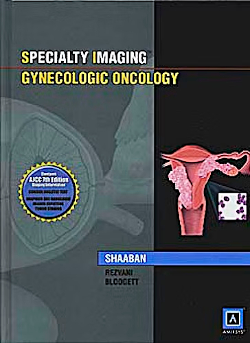 Speciality Imaging Ginecologic Oncology