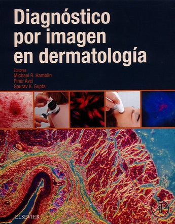 Hamblin . Avci . Gupta - Diagnóstico por Imagen en Dermatología ISBN: Marban Libros