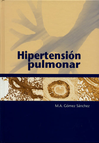 Hipertensión pulmonar