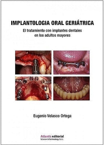 Implantología Oral Geriátrica. El Tratamiento con Implantes Dentales en Adultos Mayores ISBN: 9788494559082 Marban Libros