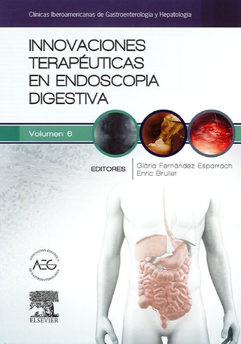 Innovaciones terapéuticas en endoscopia digestiva ISBN: 9788490229538 Marban Libros