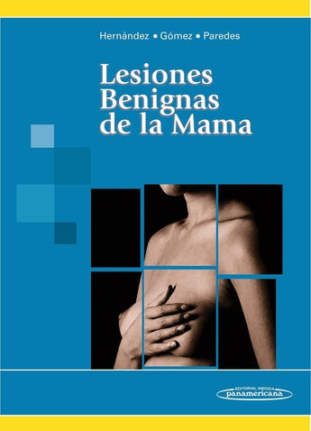 Lesiones Benignas de la Mama ISBN: 9789500600002 Marban Libros