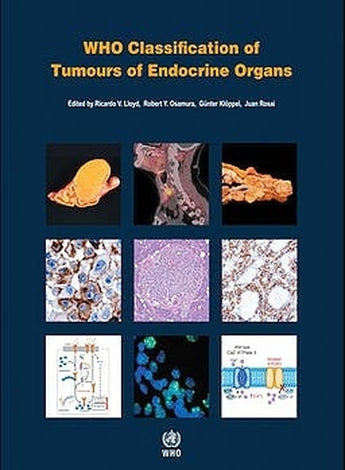 Lloyd . Osamura . Kloppel - WHO Classification of Tumours of Endocrine Organs ISBN: Marban Libros