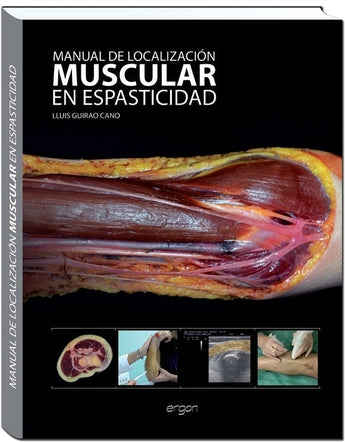 Manual de localización muscular en espasticidad ISBN: 9788415950172 Marban Libros