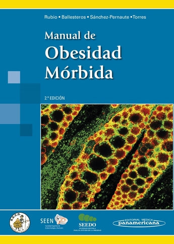 Manual de Obesidad Mórbida ISBN: 9788498358476 Marban Libros