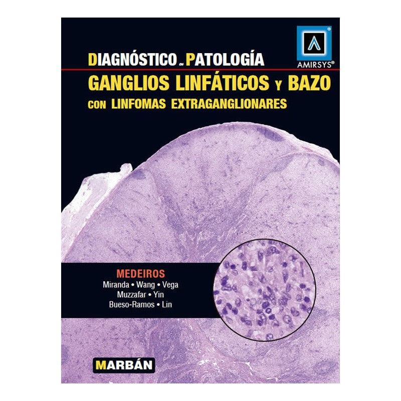 Diagnóstico en Patología  - Ganglios linfáticos y Bazo - Amirsys