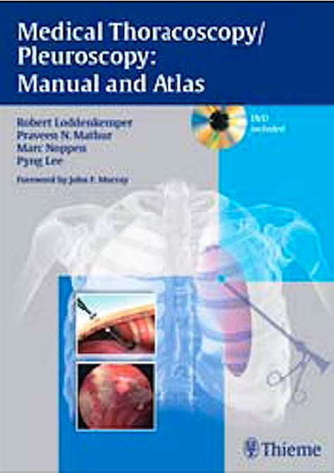 Medical Thoracoscopy Pleuroscopy: Manual and Atlas