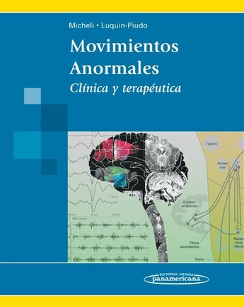 Movimientos Anormales ISBN: 9789500601337 Marban Libros