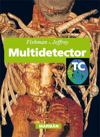 Multidetector TC ISBN: 9788471016294 Marban Libros