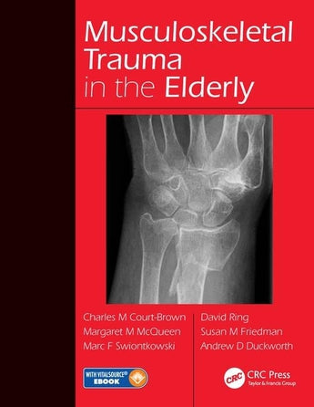 Musculoskeletal Trauma in the Elderly ISBN: 9781482252026 Marban Libros