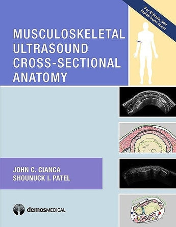 Musculoskeletal Ultrasound Cross-Sectional Anatomy ISBN: 9781620700624 Marban Libros