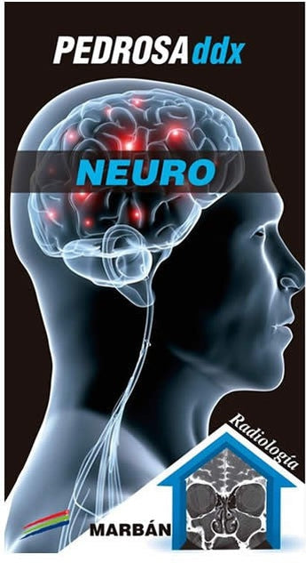 Neuro ISBN: 9788471019660 Marban Libros