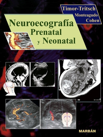 Neuroecografía Prenatal y Neonatal ISBN: 9788471013729 Marban Libros