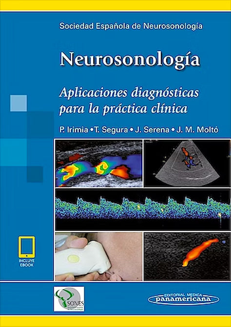 Neurosonologia. Aplicaciones diagnósticas para la práctica clínica