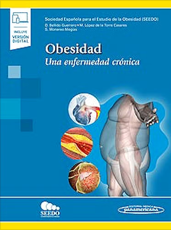 Obesidad. Una Enfermedad Crónica