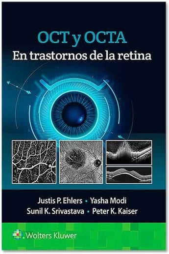 OCT y OCTA. En Trastornos de la Retina ISBN: 9788418563126 Marban Libros