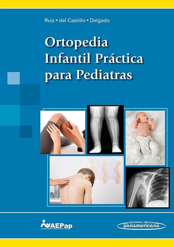 Ortopedia Infantil Práctica para Pediatras ISBN: 9788491102250 Marban Libros