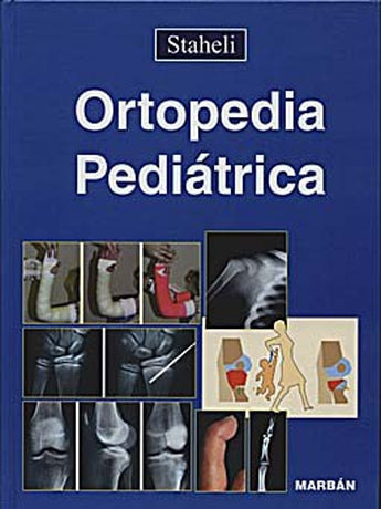 Ortopedia Pediátrica ISBN: 9788471013975 Marban Libros