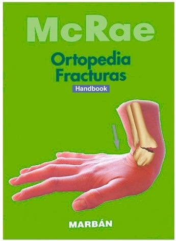 Ortopedia y Fracturas- Handbook ISBN: 9788416042647 Marban Libros