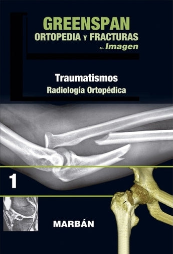 Ortopedia y Fracturas Vol 1 ISBN: 9788416042173 Marban Libros