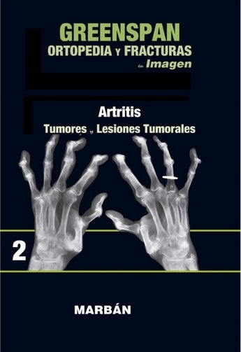 Ortopedia y Fracturas Vol 2 ISBN: 9788416042180 Marban Libros