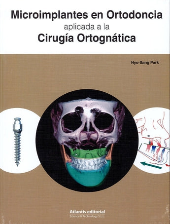 Park - Microimplantes en Ortodoncia Aplicada a la Cirugía Ortognática. ISBN: 9788494559044 Marban Libros