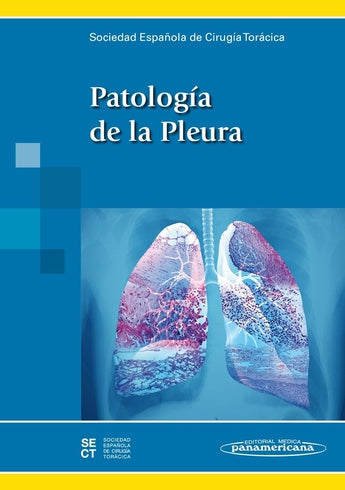 Patología de la Pleura ISBN: 9788498357929 Marban Libros