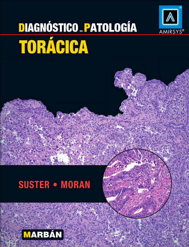Diagnóstico en Patología Torácica