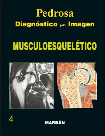 Pedrosa - Musculoesquelético ISBN: 9788471015969 Marban Libros