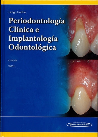 Periodontología Clínica e Implantología Vol.2º ISBN: 9789500694940 Marban Libros